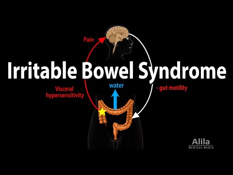 Irritable Bowel Syndrome: Pathophysiology, Symptoms, Causes, Diagnosis and Treatment, Animation